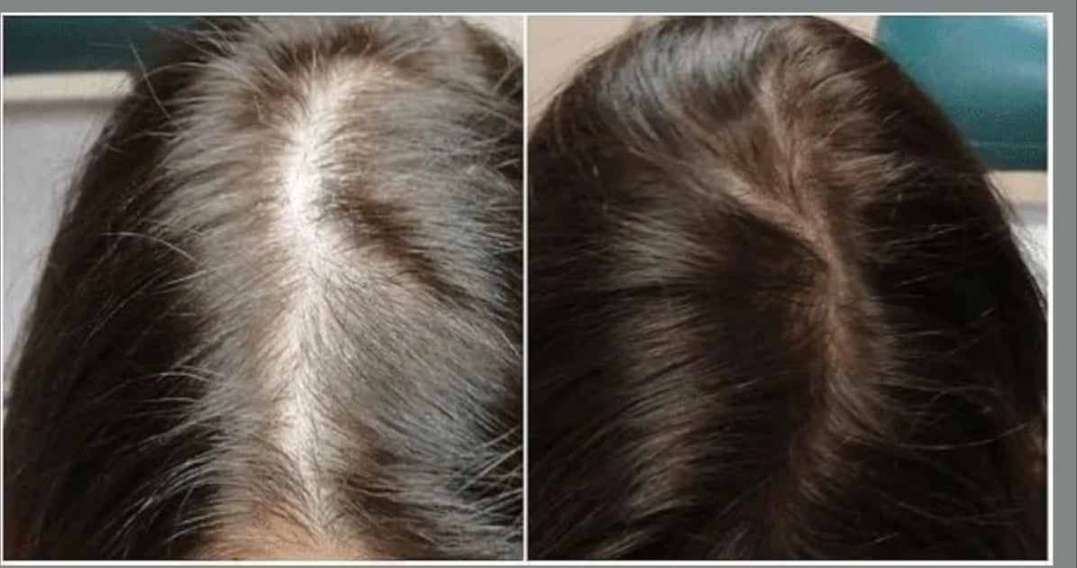 HAIRSIDR Shampooing Trésor Ancestral